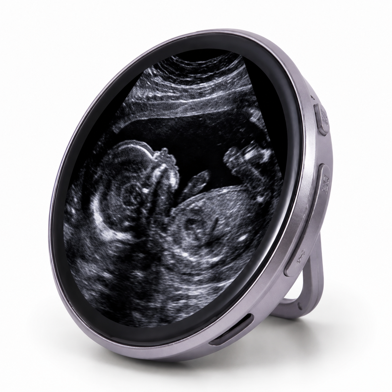 LoopBaby™ | Die erste Erinnerung an dein Baby