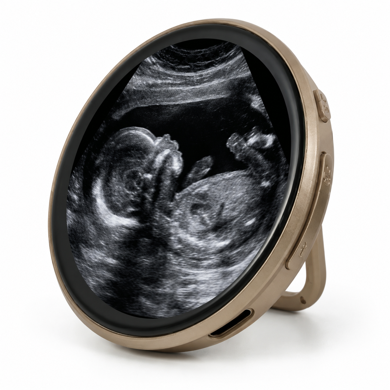 LoopBaby™ | Die erste Erinnerung an dein Baby