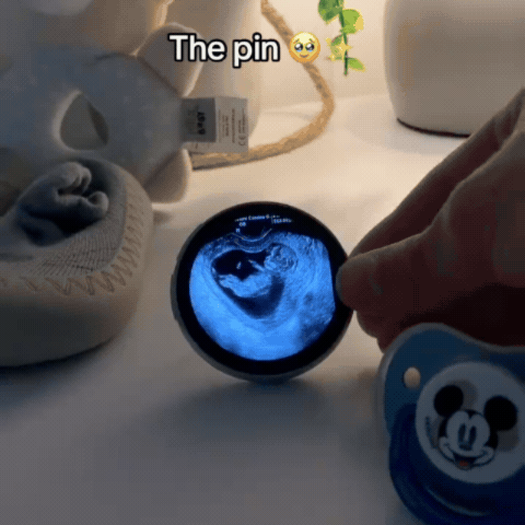 LoopBaby™ | Die erste Erinnerung an dein Baby